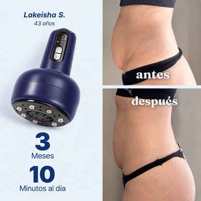SculpMag™ — Para una piel de aspecto más liso y uniforme